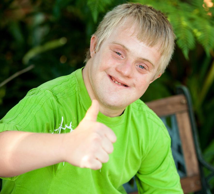Children with Down syndrome often have distinct facial features.