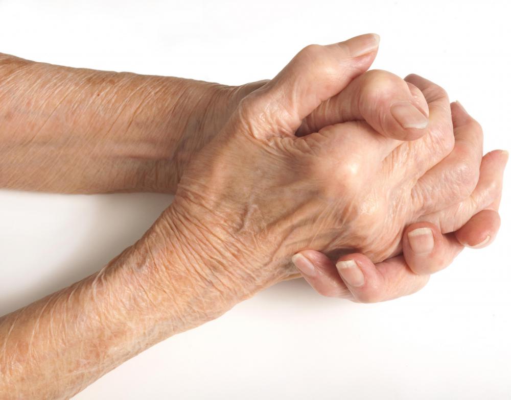 Boswellia may be used to treat arthritis.