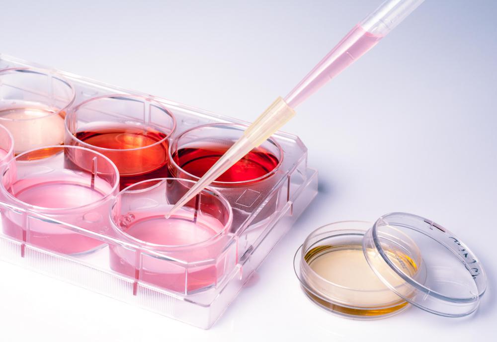 Blood samples may be taken to check for spirochaetes, and the samples may be cultured to determine the best antibiotic to use.