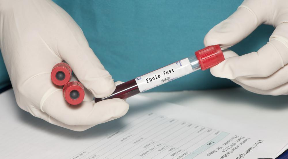 Research into gorillas who died from the ebola virus may help make medical breakthroughs for people who contract the disease.
