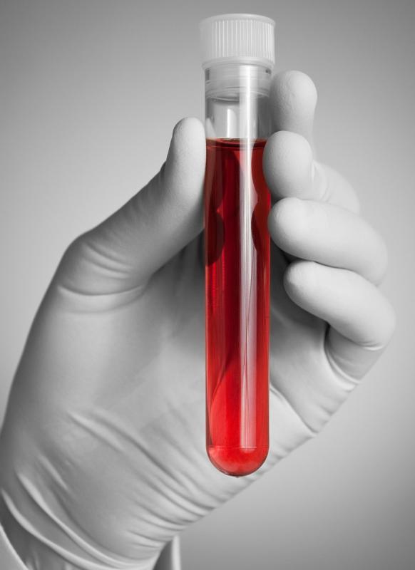 A vet may perform blood tests to determine health reasons for why a cat is eating kitty litter.