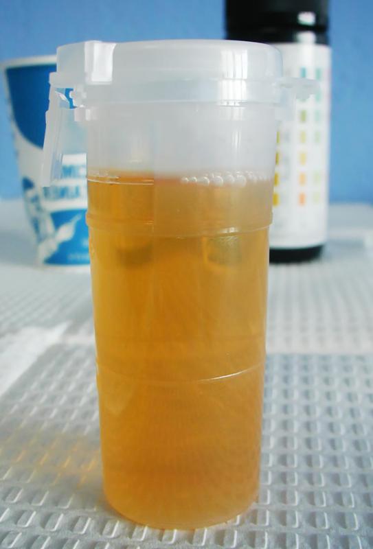 A veterinarian will conduct a urinalysis to determine which strand of bacteria the dog is infected with.