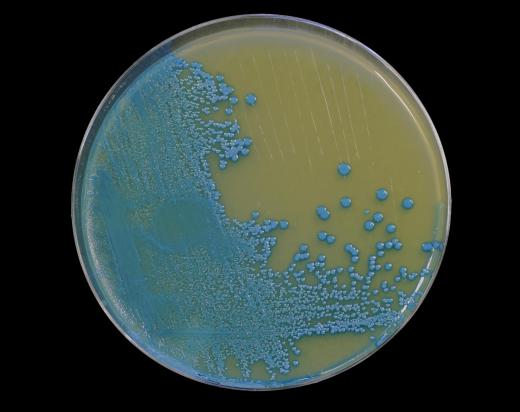 Bacteria in a petri dish.